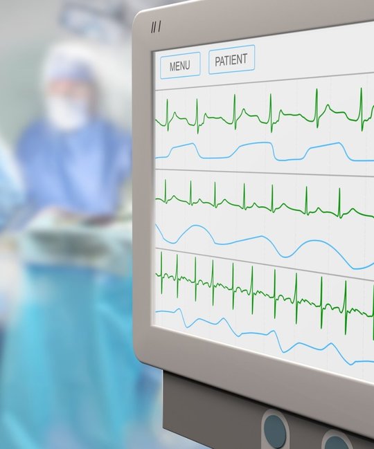 Diagramme auf Monitor im Krankenhaus