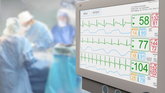 Diagramme auf Monitor im Krankenhaus