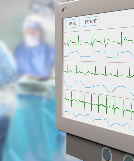 Diagramme auf Monitor im Krankenhaus