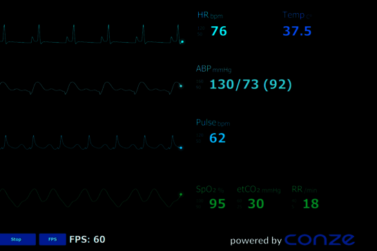 CONZE Patient Monitor GUI
